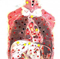 /album/fotogaleria-celkovy-stav-organizmu/rez-hrudnikom-jpg1/